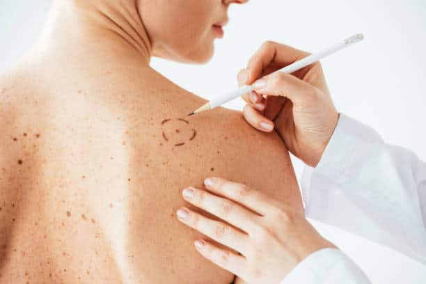 visita dermatologica domiciliare